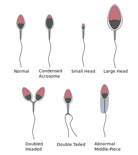 Types of sperm morphology